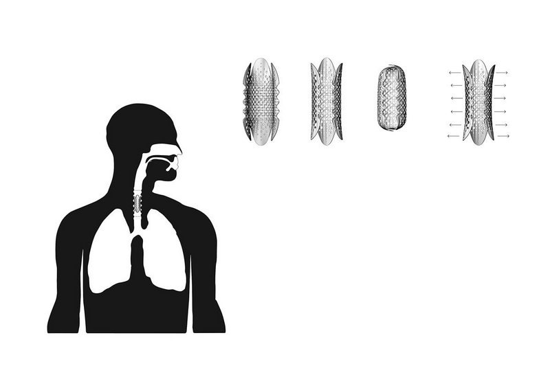 Close-ups of the stent denoting designed deployment positions.